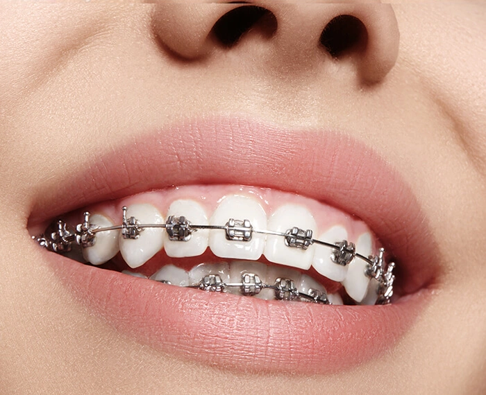 orthodontics