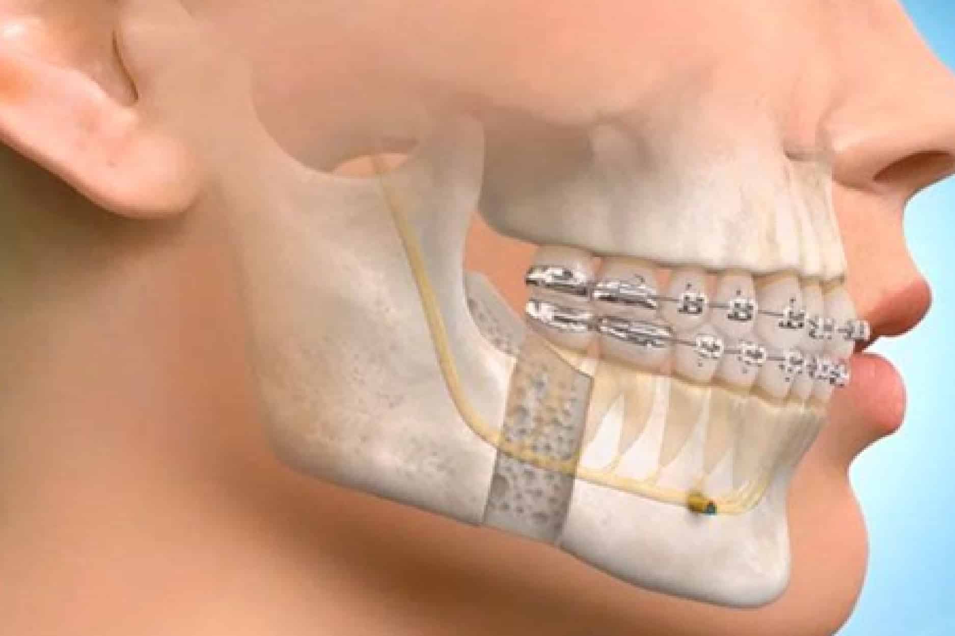 Oral-Maxillofacial-Surgery-01-1