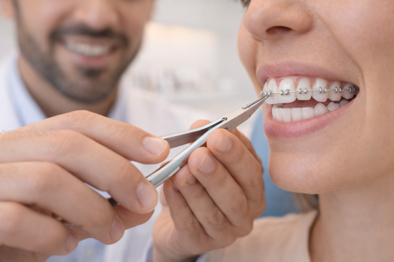 Treatment Process at Smile On Dental Clinic