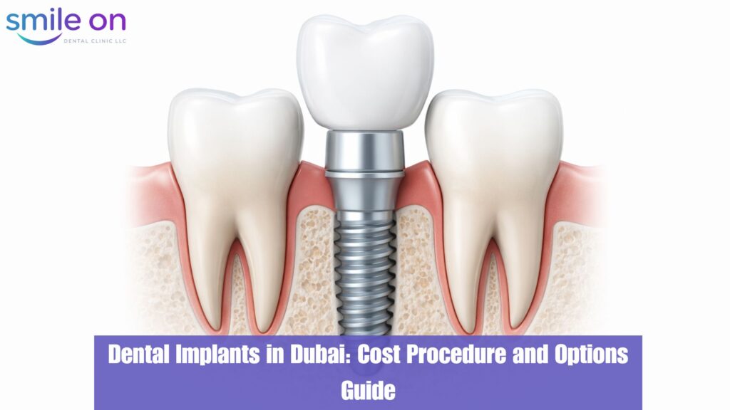 Dental Implants in Dubai: Costs, Procedure & How to Choose the Right Clinic