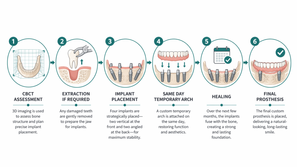 Dental implant treatment process infographic