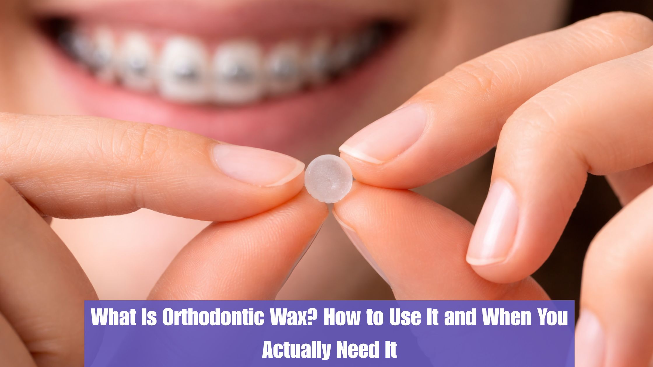 What Is Orthodontic Wax? How to Use It and When You Actually Need It
