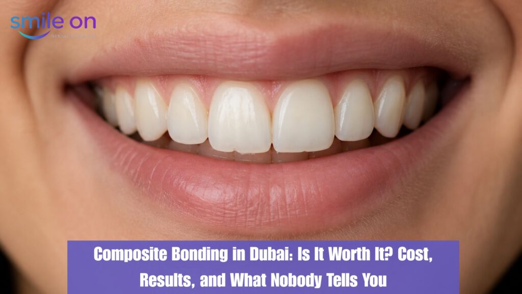 Composite Bonding in Dubai: Is It Worth It? Cost, Results, and What Nobody Tells You