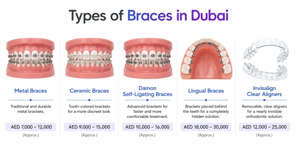 Visual comparison of five types of braces available in Dubai with price ranges