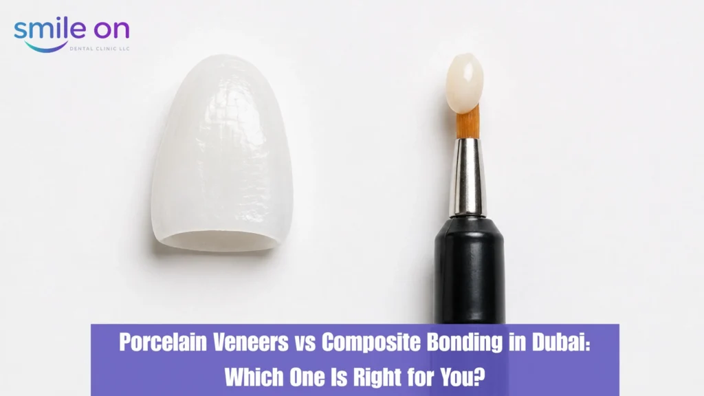 Porcelain veneer vs composite bonding — cosmetic dentistry treatment comparison at Smile On Dental Clinic Dubai