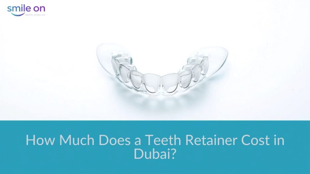 Teeth Retainer Cost in Dubai