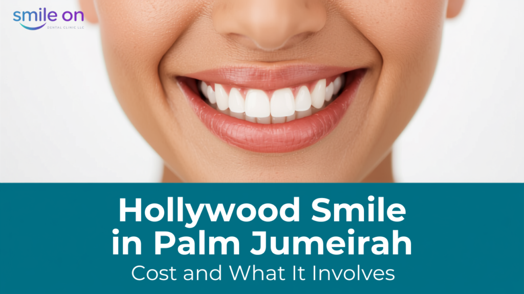 Hollywood smile makeover in Palm Jumeirah - close-up smile