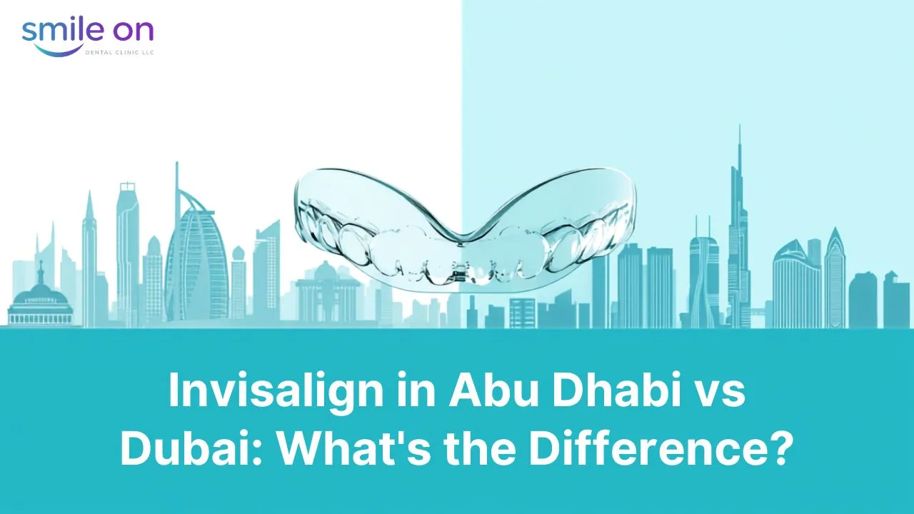 Invisalign in Abu Dhabi vs Dubai: What is the Difference? — Smile On Dental Clinic