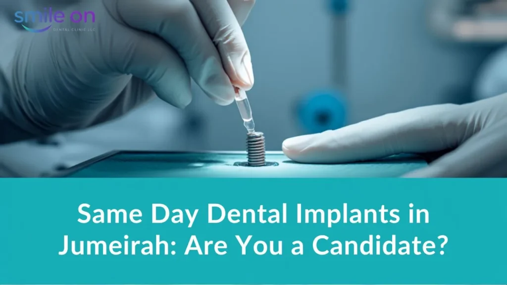 Same Day Dental Implants in Jumeirah: Are You a Candidate? — Smile On Dental Clinic