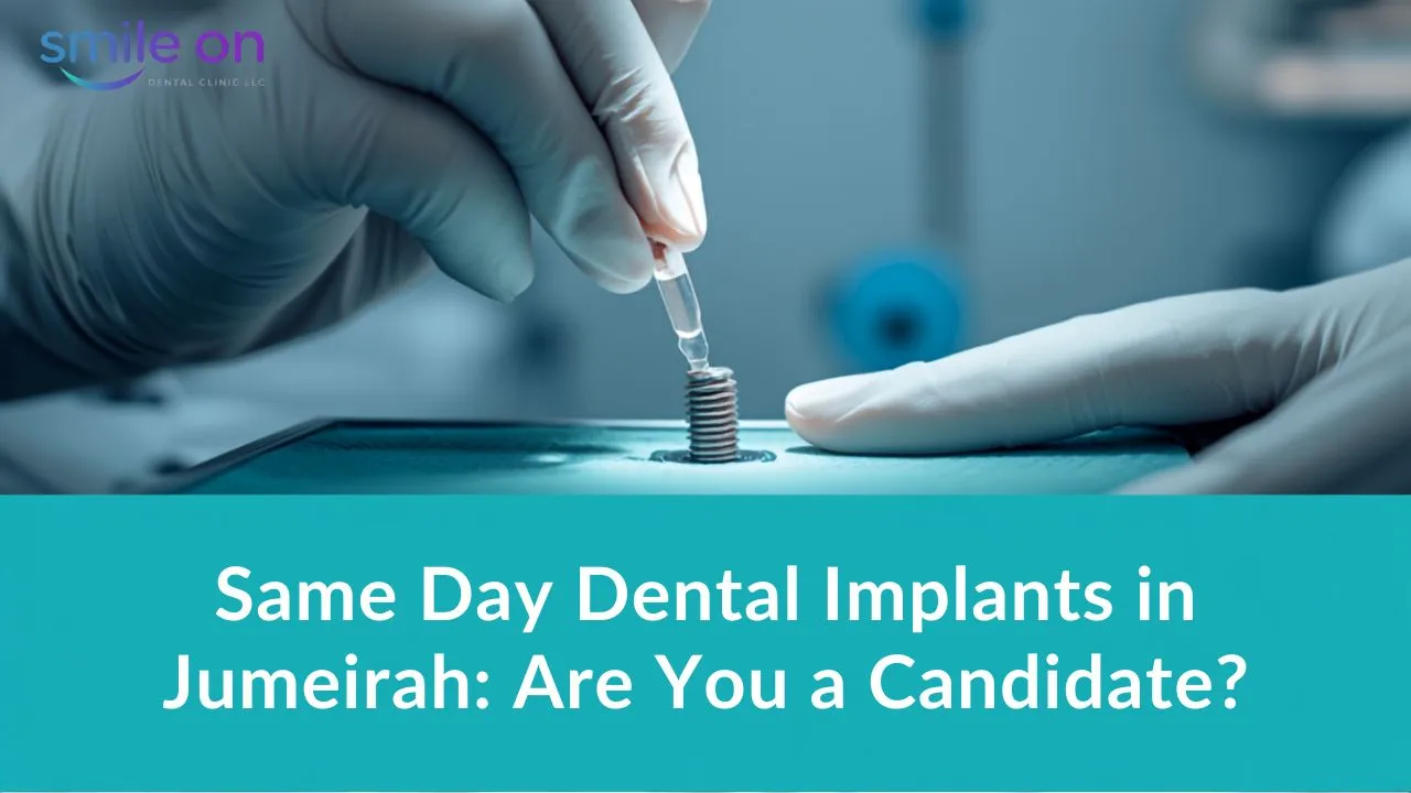 Same Day Dental Implants in Jumeirah: Are You a Candidate? — Smile On Dental Clinic