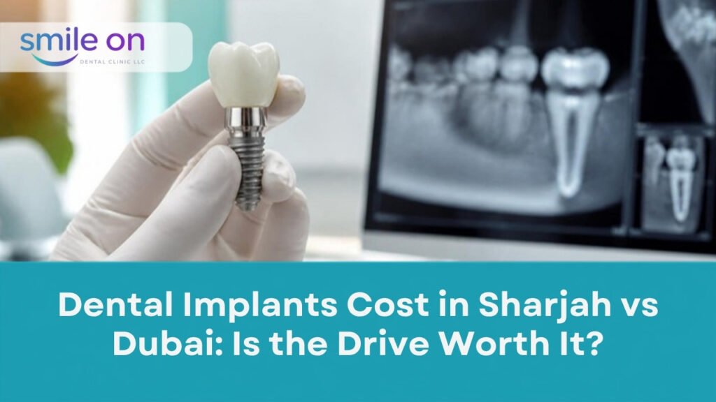 Dental Implants Cost in Sharjah vs Dubai: Is the Drive Worth It? Smile On Dental Clinic
