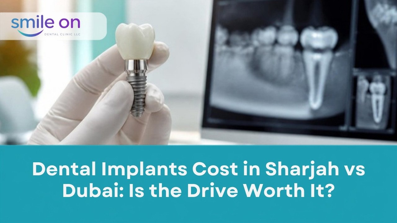 Dental Implants Cost in Sharjah vs Dubai: Is the Drive Worth It? Smile On Dental Clinic