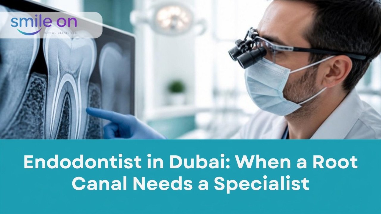 Endodontist in Dubai: When a Root Canal Needs a Specialist, Smile On Dental Clinic