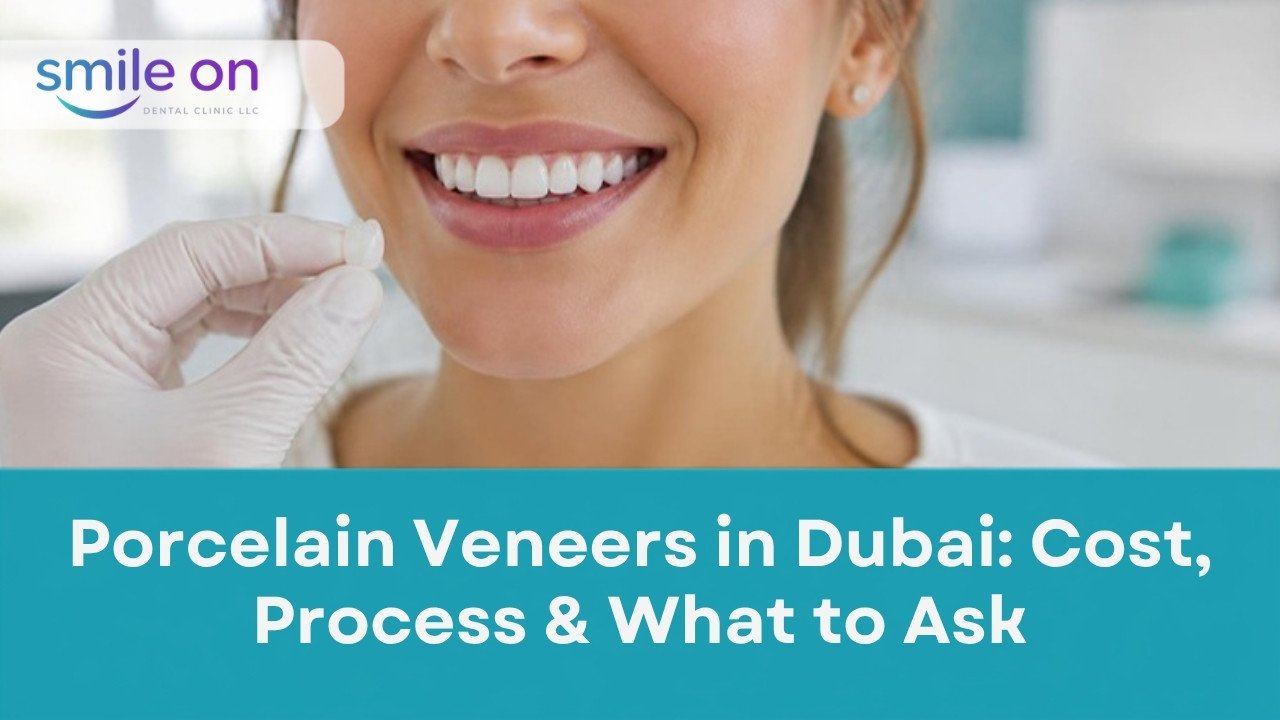 Porcelain Veneers in Dubai: Cost, Process and What to Ask, Smile On Dental Clinic
