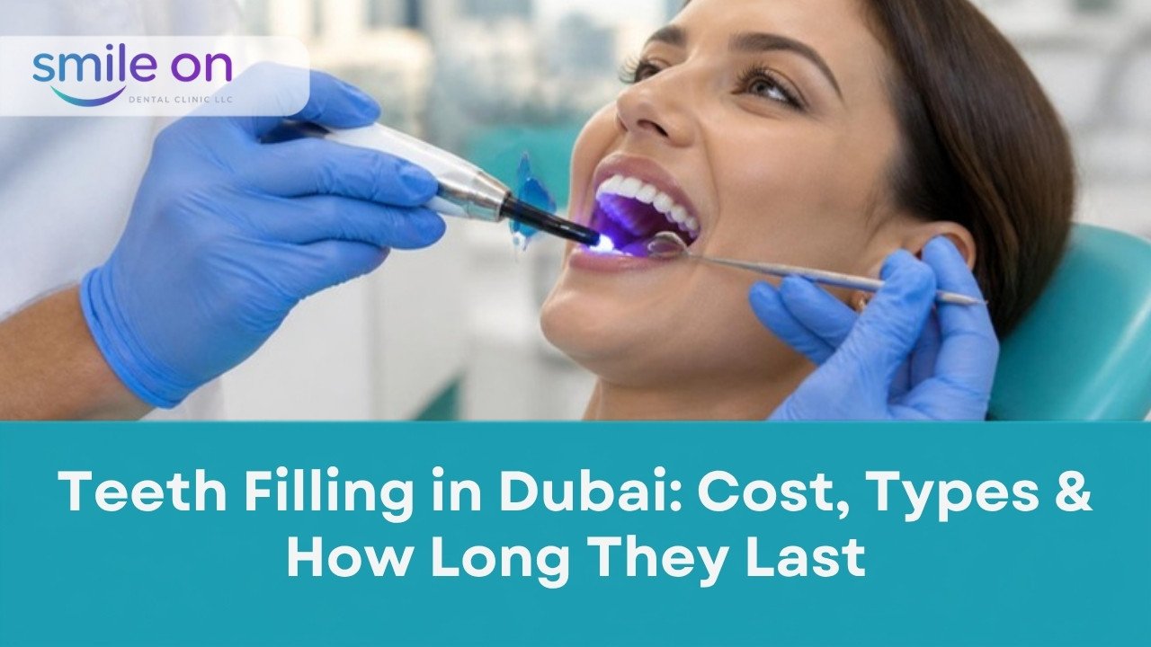 Teeth filling in Dubai: dentist placing a white composite filling, Smile On Dental Clinic