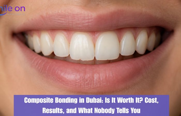 Composite Bonding in Dubai: Is It Worth It? Cost, Results, and What Nobody Tells You