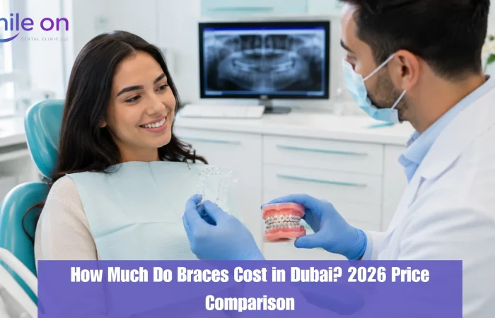 How Much Do Braces Cost in Dubai? A Full Price Comparison for 2026