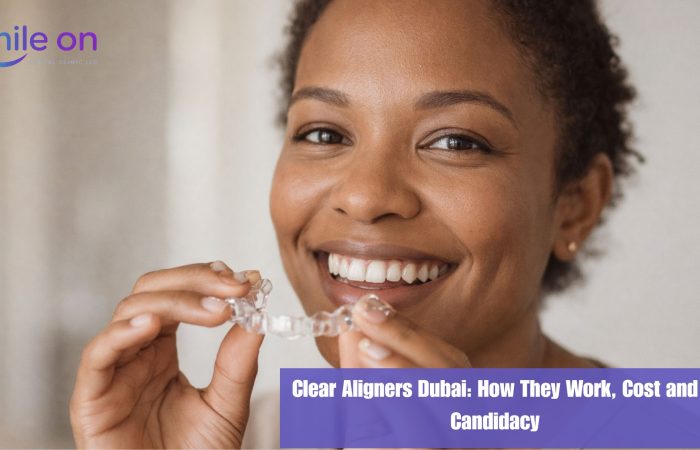 Clear Aligners: How They Work, What They Cost, and Whether They're Right for You