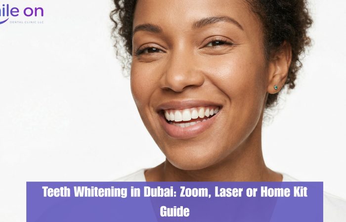 Teeth Whitening in Dubai: Zoom, Laser, or Home Kits Which One Actually Works?
