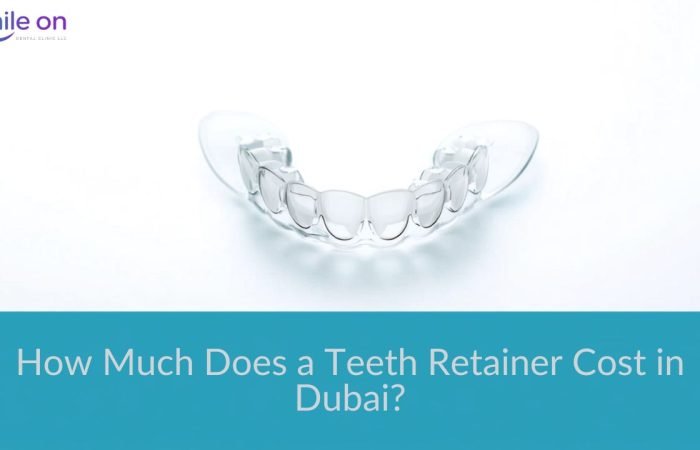 Teeth Retainer Cost in Dubai