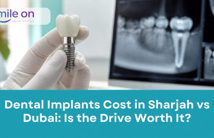 Dental Implants Cost in Sharjah vs Dubai: Is the Drive Worth It? Smile On Dental Clinic