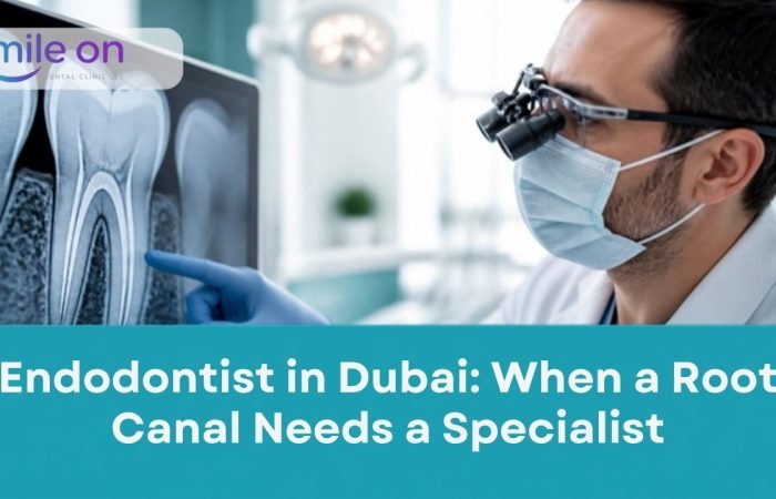 Endodontist in Dubai: When a Root Canal Needs a Specialist, Smile On Dental Clinic