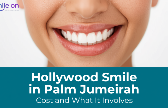 Hollywood smile makeover in Palm Jumeirah - close-up smile