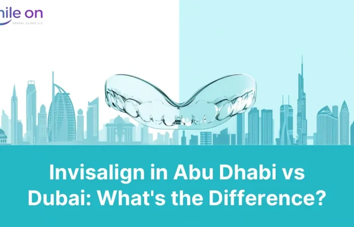 Invisalign in Abu Dhabi vs Dubai: What's the Difference? — Smile On Dental Clinic