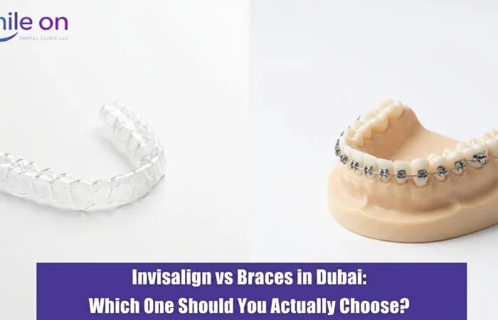 Invisalign vs Braces in Dubai: Which One Should You Actually Choose?