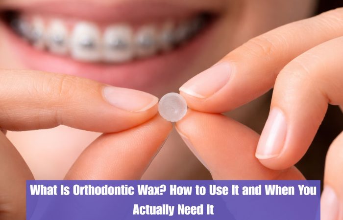 What Is Orthodontic Wax? How to Use It and When You Actually Need It