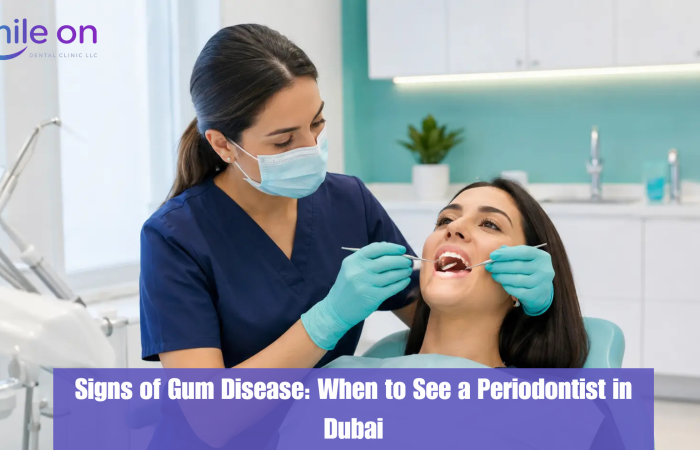 Signs of Gum Disease: When to See a Periodontist in Dubai