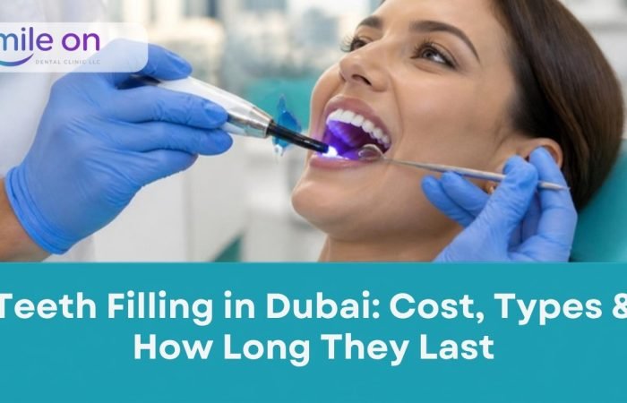 Teeth filling in Dubai: dentist placing a white composite filling, Smile On Dental Clinic