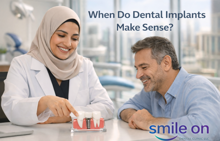 When do dental implants